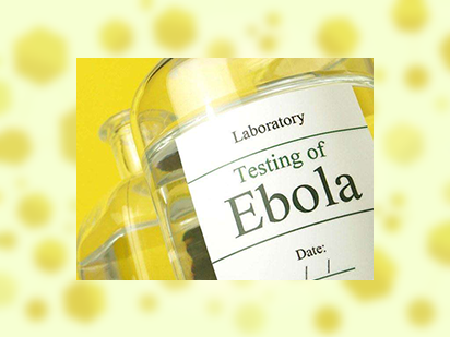 Wang ZY,et al. Genome-Wide Search for Competing Endogenous RNAs Responsible for the Effects Induced by Ebola Virus Replication and Transcription Using a trVLP System.Front Cell Infect Microbiol.?2017 Nov 21;7:479.(IF=4.5)